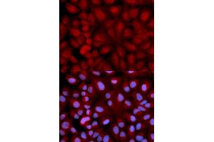 Immunofluorescence analysis of U2OS cells using SNCG antibody (ABIN5971355). (SNCG antibody)