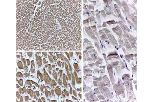 Rabbit Anti-PPAR delta (N terminal specific) 1:500 (PPARD antibody  (N-Term))