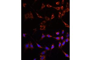 Immunofluorescence analysis of NIH-3T3 cells using PTPN13 Polyclonal Antibody (ABIN6132534, ABIN6146442, ABIN6146443 and ABIN6216830) at dilution of 1:100 (40x lens).