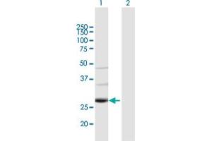 Western Blotting (WB) image for anti-TAF9B RNA Polymerase II, TATA Box Binding Protein (TBP)-Associated Factor, 31kDa (TAF9B) (AA 1-251) antibody (ABIN949345)