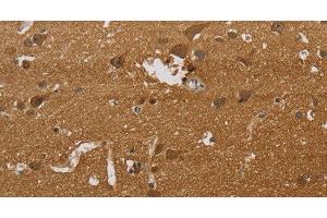 Immunohistochemistry of paraffin-embedded Human brain tissue using ELAVL2 Polyclonal Antibody at dilution 1:40 (ELAVL2 antibody)