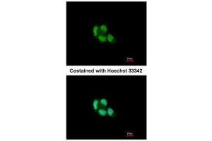 ICC/IF Image Immunofluorescence analysis of paraformaldehyde-fixed A431, using Proteasome 20S beta 5, antibody at 1:200 dilution. (PSMB5 antibody  (C-Term))