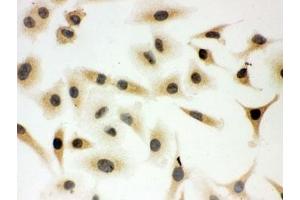 ICC testing of SHC antibody and A549 cells (SHC1 antibody  (C-Term))