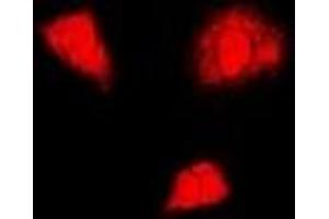 Immunofluorescent analysis of PSMA6 staining in U2OS cells.
