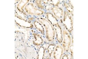 Immunohistochemistry of paraffin-embedded human kidney using [KO Validated] Granulin Rabbit mAb  at dilution of 1:500 (40x lens). (Granulin antibody)