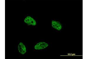 Immunofluorescence of monoclonal antibody to DUSP4 on HeLa cell. (DUSP4 antibody  (AA 1-394))