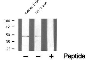 Western blot analysis of extracts of various Tissue ,using TRIM59 antibody. (TRIM59 antibody  (Internal Region))