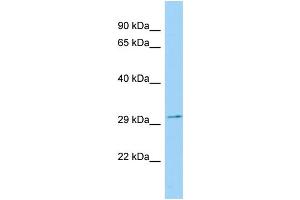 WB Suggested Anti-Rcan1 Antibody Titration: 1. (RCAN1 antibody  (N-Term))