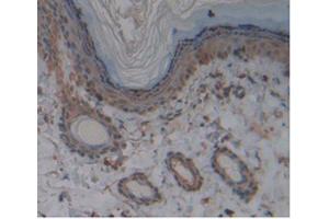IHC-P analysis of Rat Skin Tissue, with DAB staining. (KIT antibody)