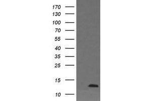 Image no. 1 for anti-D-Dopachrome Tautomerase (DDT) antibody (ABIN1497795) (DDT antibody)