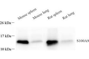Western blot analysis of S100A9 (ABIN7075497) at dilution of 1: 800 (S100A9 antibody)