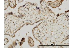 Immunostaining (ISt) image for anti-Mitogen-Activated Protein Kinase-Activated Protein Kinase 3 (MAPKAPK3) (AA 272-382) antibody (ABIN563496)