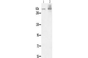 Gel: 6 % SDS-PAGE, Lysate: 40 μg, Lane 1-2: A549 cells, K562 cells, Primary antibody: ABIN7191019(HSPG2 Antibody) at dilution 1/200, Secondary antibody: Goat anti rabbit IgG at 1/8000 dilution, Exposure time: 40 seconds (HSPG2 antibody)