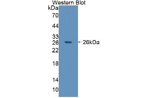 Detection of Recombinant PTPN21, Mouse using Polyclonal Antibody to Protein Tyrosine Phosphatase, Non Receptor Type 21 (PTPN21) (PTPN21 antibody  (AA 983-1176))