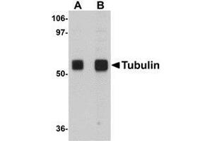Western blot analysis of Tubulin in rat brain tissue lysate with AP30046PU-N Tubulin antibody at (A) 0.