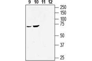 GPR55 antibody  (2nd Extracellular Loop)