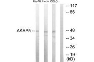 Western blot analysis of extracts from HepG2/HeLa/COLO205 cells, using AKAP5 Antibody. (AKAP5 antibody  (AA 1-50))