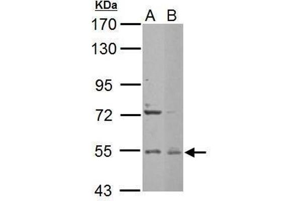 EDC3 antibody  (Internal Region)