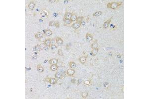 Immunohistochemistry (Paraffin-embedded Sections) (IHC (p)) image for anti-Charged Multivesicular Body Protein 1B (CHMP1B) (AA 1-199) antibody (ABIN6138541)