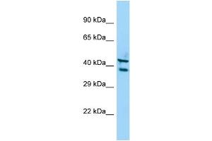 Host: Rabbit Target Name: STK35 Sample Type: A549 Whole Cell lysates Antibody Dilution: 1. (STK35 antibody  (C-Term))