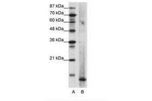 Image no. 1 for anti-MDS1 and EVI1 Complex Locus (MECOM) (N-Term) antibody (ABIN202037) (MECOM antibody  (N-Term))