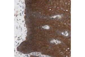 Immunohistochemical staining of human esophagus with CCDC67 polyclonal antibody  shows strong cytoplasmic positivity in squamous epithelial cells. (CCDC67 antibody)
