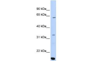 Western Blotting (WB) image for anti-AT Rich Interactive Domain 5A (MRF1-Like) (ARID5A) antibody (ABIN2459453) (ARID5A antibody)