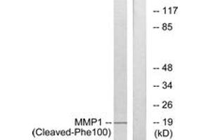 Western blot analysis of extracts from A549 cells, treated with etoposide 25uM 24h, using MMP1 (Cleaved-Phe100) Antibody. (MMP1 antibody  (Cleaved-Phe100))