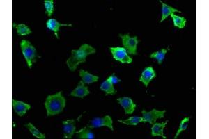 Immunofluorescence staining of SH-SY5Y cells with ABIN7140086 at 1:50, counter-stained with DAPI. (DCHS1 antibody  (AA 2964-2981))