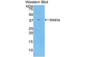 Western blot analysis of the recombinant protein. (Annexin V antibody  (AA 1-321))