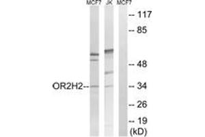 Western blot analysis of extracts from Jurkat/MCF-7 cells, using OR2H2 Antibody. (OR2H2 antibody  (AA 241-290))