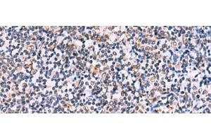 Immunohistochemistry of paraffin-embedded Human tonsil tissue using NMRK2 Polyclonal Antibody at dilution of 1:55(x200)