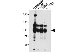 All lanes : Anti-NLRP6 Antibody (N-term) at 1:4000 dilution Lane 1: Human placenta tissue lysate Lane 2: HL-60 whole cell lysate Lane 3: Jurkat whole cell lysate Lane 4: U266B1 whole cell lysate Lysates/proteins at 20 μg per lane.