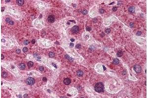 Human Liver: Formalin-Fixed, Paraffin-Embedded (FFPE) (DYNLL1 antibody  (N-Term))
