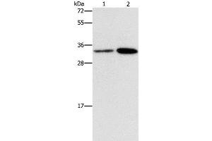 Western Blot analysis of Hela and A431 cell using CDC34 Polyclonal Antibody at dilution of 1:900 (CDC34 antibody)