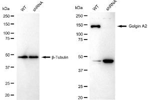 Western blotting analysis using Golgin A2 antibody (ABIN7798797).