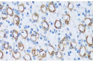 Immunohistochemistry of paraffin-embedded Mouse kidney using CA13 Polyclonal Antibody at dilution of 1:100 (40x lens). (CA13 antibody)