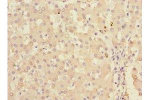 Immunohistochemistry of paraffin-embedded human liver tissue using ABIN7157477 at dilution of 1:100