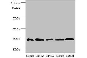 Western blot All lanes: Gstp1 antibody at 2 μg/mL Lane 1: Mouse kidney tissue Lane 2: Jurkat whole cell lysate Lane 3: K562 whole cell lysate Lane 4: 293T whole cell lysate Lane 5: Hela whole cell lysate Secondary Goat polyclonal to rabbit IgG at 1/10000 dilution Predicted band size: 24 kDa Observed band size: 24 kDa (GSTP1 antibody  (AA 2-210))