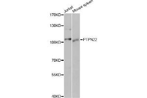 Western blot analysis of extracts of various cell lines, using PTPN22 antibody (ABIN5970653) at 1/1000 dilution. (PTPN22 antibody)