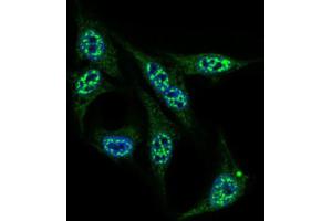 Immunofluorescence analysis of HepG2 cells using INCENP antibody (green). (INCENP antibody  (AA 369-583))