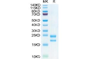Biotinylated Human VEGF121 on Tris-Bis PAGE under reduced condition. (VEGF121 Protein (His-Avi Tag,Biotin))