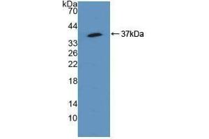 Detection of Recombinant SQSTM1, Human using Polyclonal Antibody to Sequestosome 1 (SQSTM1) (SQSTM1 antibody  (AA 136-400))