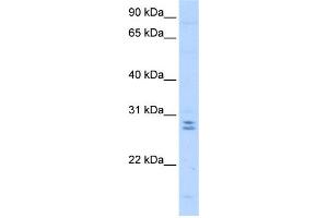 WB Suggested Anti-MED4 Antibody Titration:  0. (MED4 antibody  (C-Term))