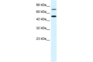 Western Blotting (WB) image for anti-Choroideremia-Like (Rab Escort Protein 2) (CHML) antibody (ABIN2463728) (CHML antibody)