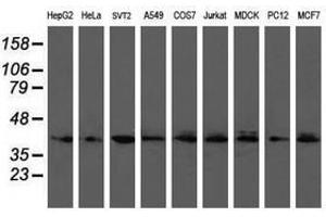 Image no. 3 for anti-Ubiquitin-Conjugating Enzyme E2, J1, U (UBE2J1) antibody (ABIN1501638)