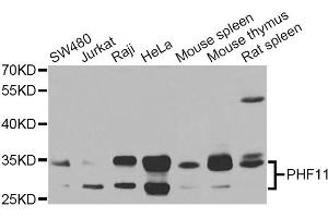 Western blot analysis of extracts of various cell lines, using PHF11 Antibody (ABIN5975729) at 1/1000 dilution. (PHF11 antibody)