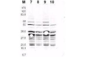 This product was assayed by western blotting against RFA2 containing cell lysates. (RPA2 antibody  (pSer122))