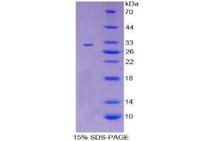 SDS-PAGE (SDS) image for CD109 (CD109) (AA 719-965) protein (His tag) (ABIN2124358) (CD109 Protein (CD109) (AA 719-965) (His tag))