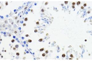 Immunohistochemistry (Paraffin-embedded Sections) (IHC (p)) image for anti-Zinc Finger E-Box Binding Homeobox 1 (ZEB1) antibody (ABIN7261540)